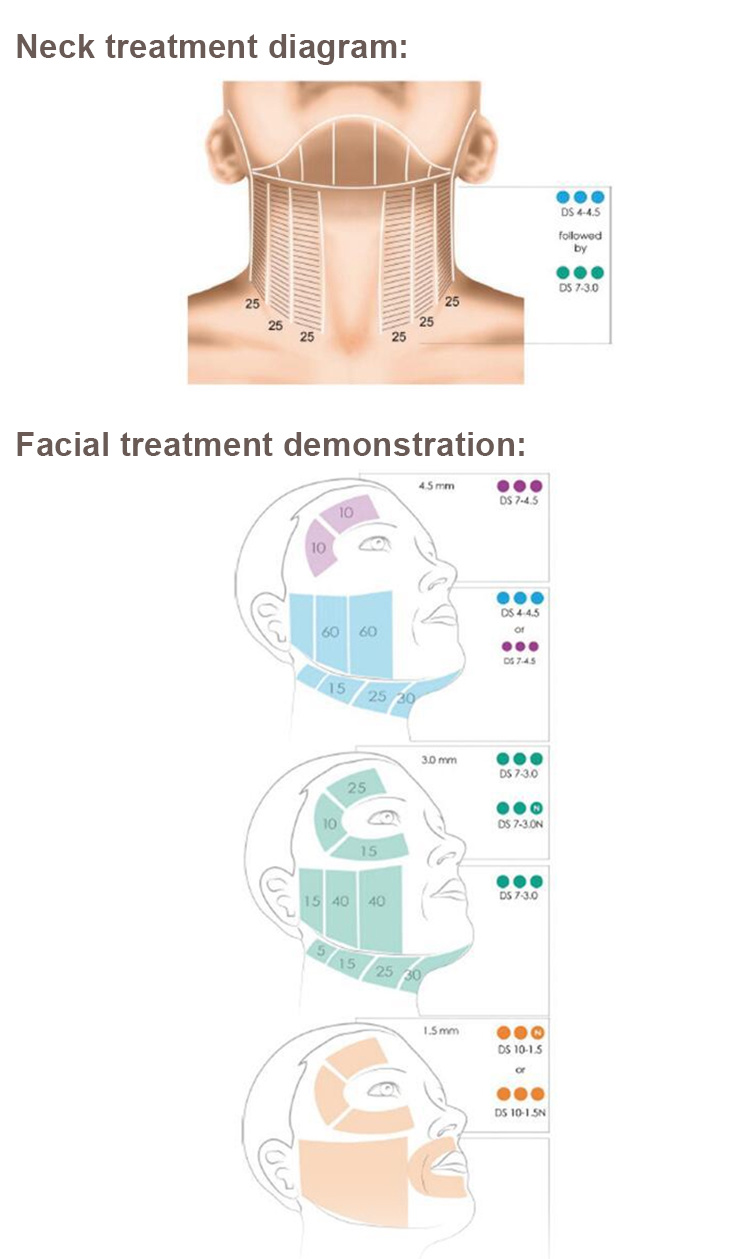 Newest Facial Beauty 4D Hifu Anti Aging Machine for Sale