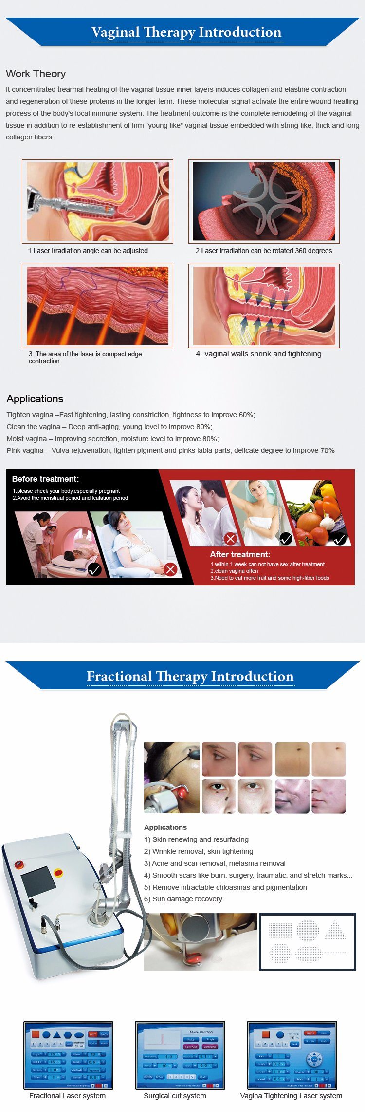 2018 New Vaginal Tightening Machine/ Fractional CO2 Laser/Home Use Fractional Laser CO2