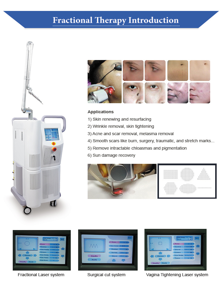 5 in 1 Multifunctional Vaginal Tightening Machine CO2 Fractional Laser Vaginal Rejuvenation