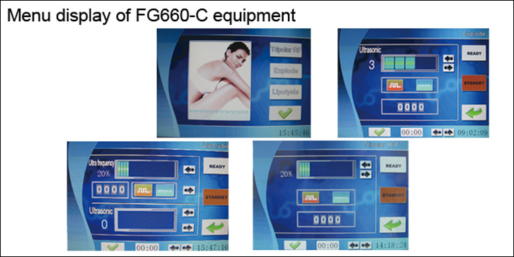 Hot - Selling Ultrasound Tripolar Radio Frequency Body Weight Loss Machine.