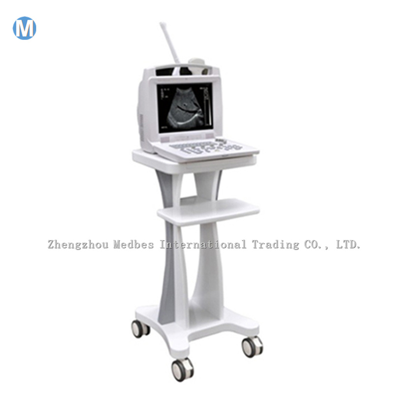 China Lowest Price Ophthalmic Ultrasound a B Scan Medical Equipment