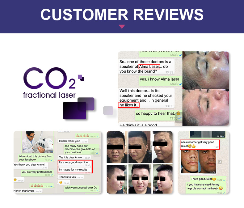 Best Quality CO2 Fractional Laser Treatment Laser Machine CO2 Fractional Laser Equipment