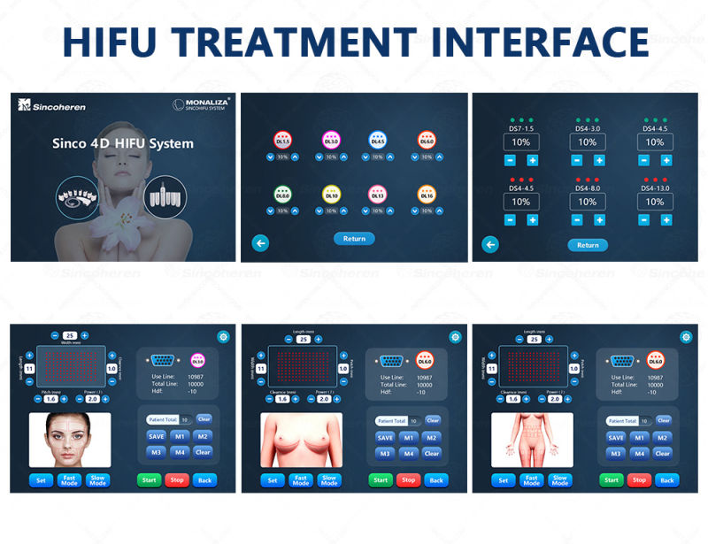 2020 4D Hifu Ultrasound Line V-Max Face Lifting 2 in 1 Hifu Machine