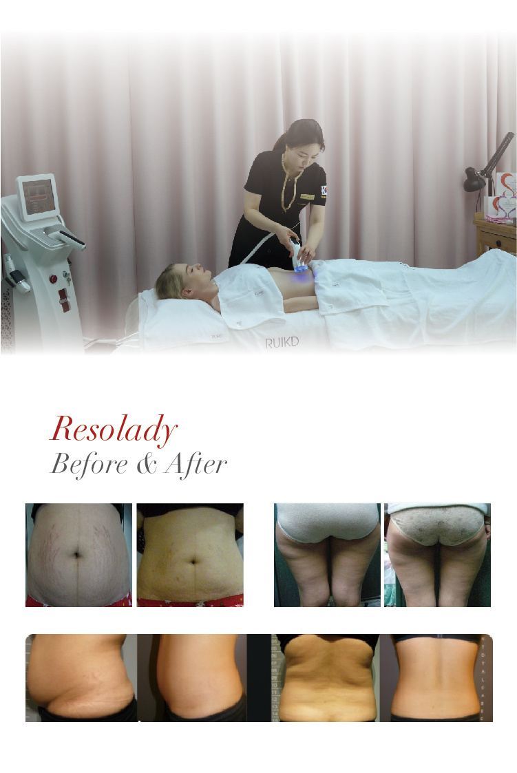 Korea RF Body Slimming/ Facial Lifting Equipment for Beauty Salon