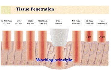 810nm Diode Laser Hair Removal/Depilation Beauty Machine