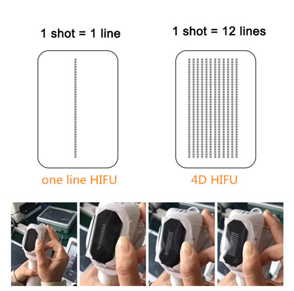 4 in 1 4D 3D Hifu Vmax Liposonix Hifu Vaginal Tightening Cellulite Treatment Machine
