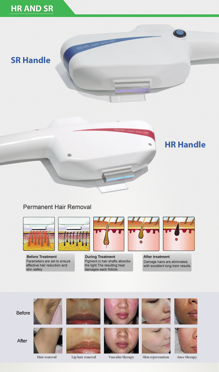 Vertical IPL Shr / Dpl System Hair Removal Device for Sale