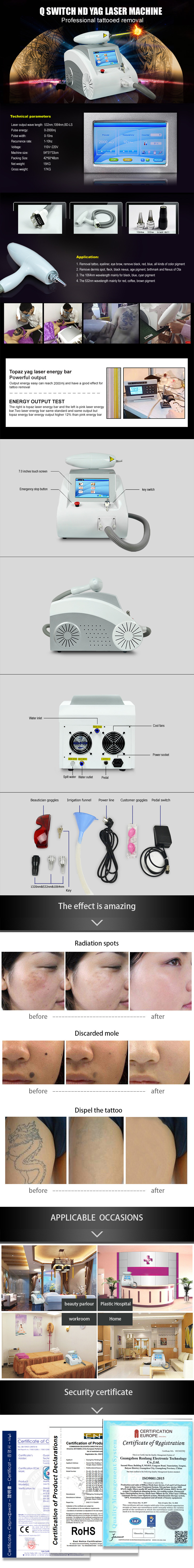 Renlang Q-Switch ND YAG Laser Tattoo Removal Machine China Manufacturer