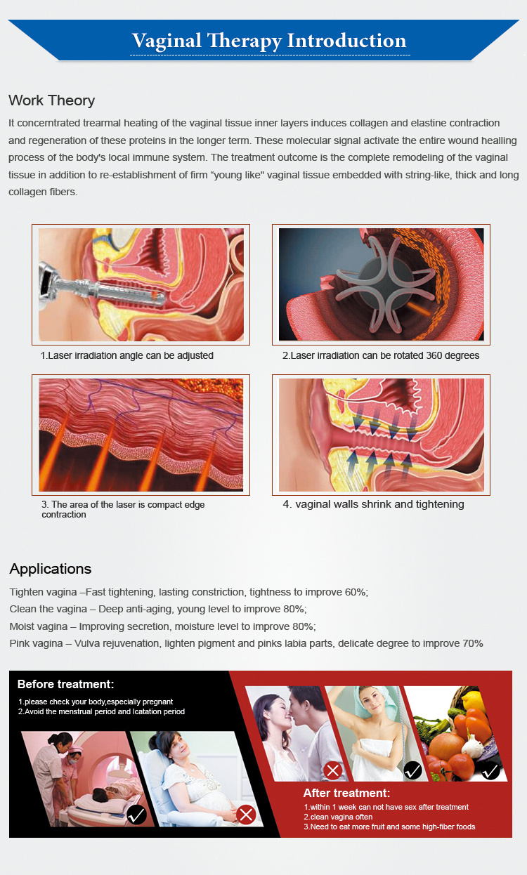 CO2 Vaginal Laser Fractional CO2 Laser Vaginal Tightening Machine