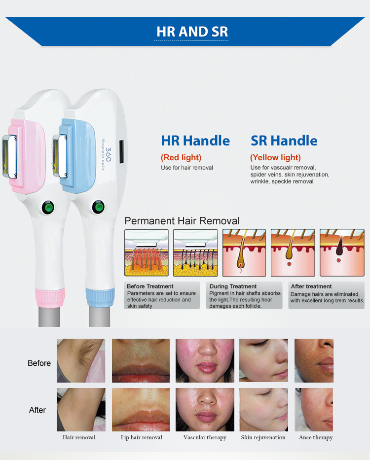 2 Handles IPL Opt Shr IPL Hair Removal Laser Machines