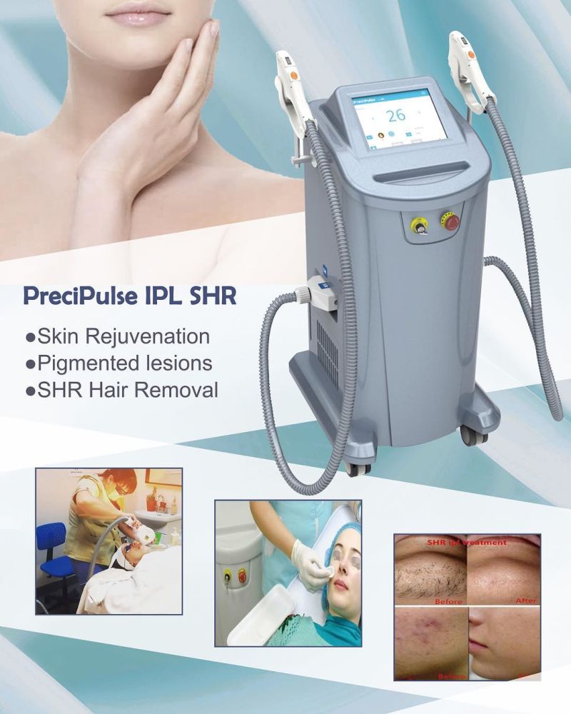 Lowest Price Cosmetic IPL Machine Permanent Hair Removal /Hot Selling IPL Hair Removal/Elight+IPL+Laser with Ce Certificate