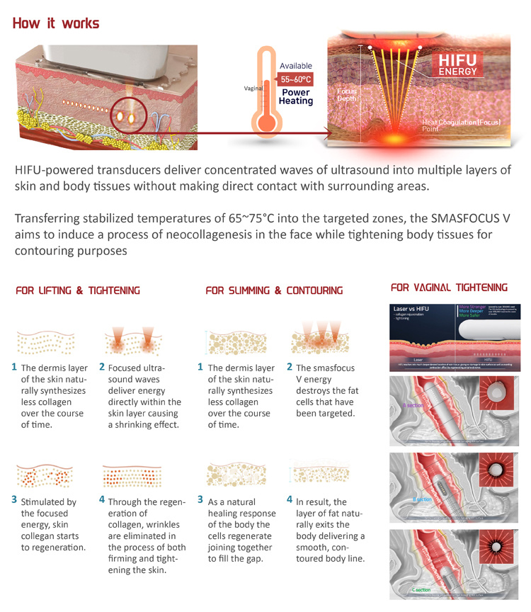 Hifu Skin Tightening Skin Tighten Machine Hifu Ultrasound Face Lift Machine