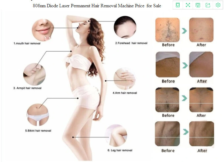 Salon Beauty Equipment Desktop 808nm Diode Laser Hair Removal Machine