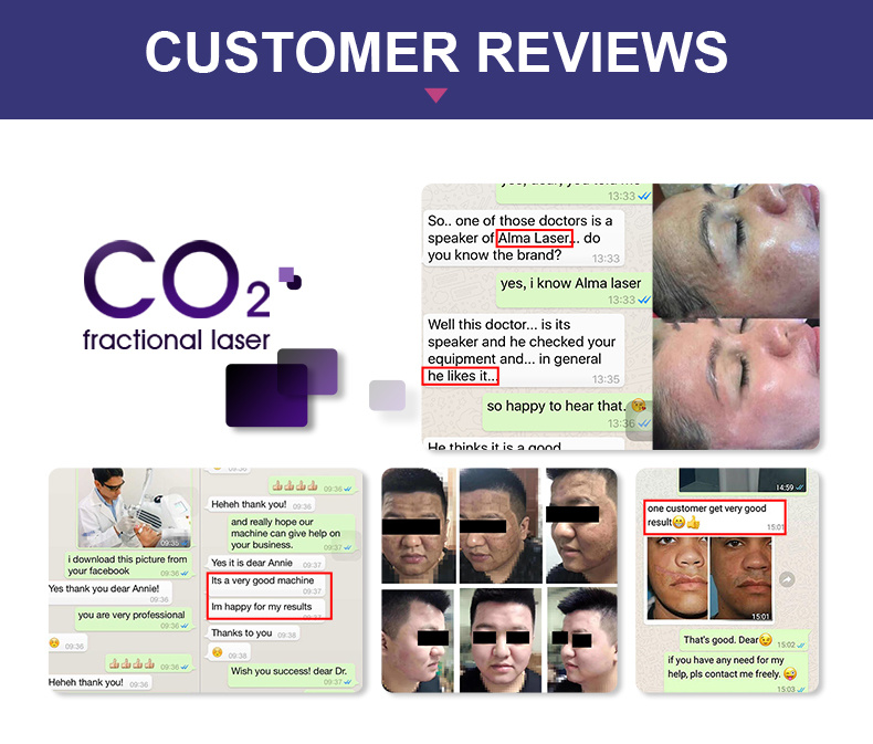 Best CO2 Fractional Laser Treatment Laser Machine CO2 Fractional Laser Machine for Sale