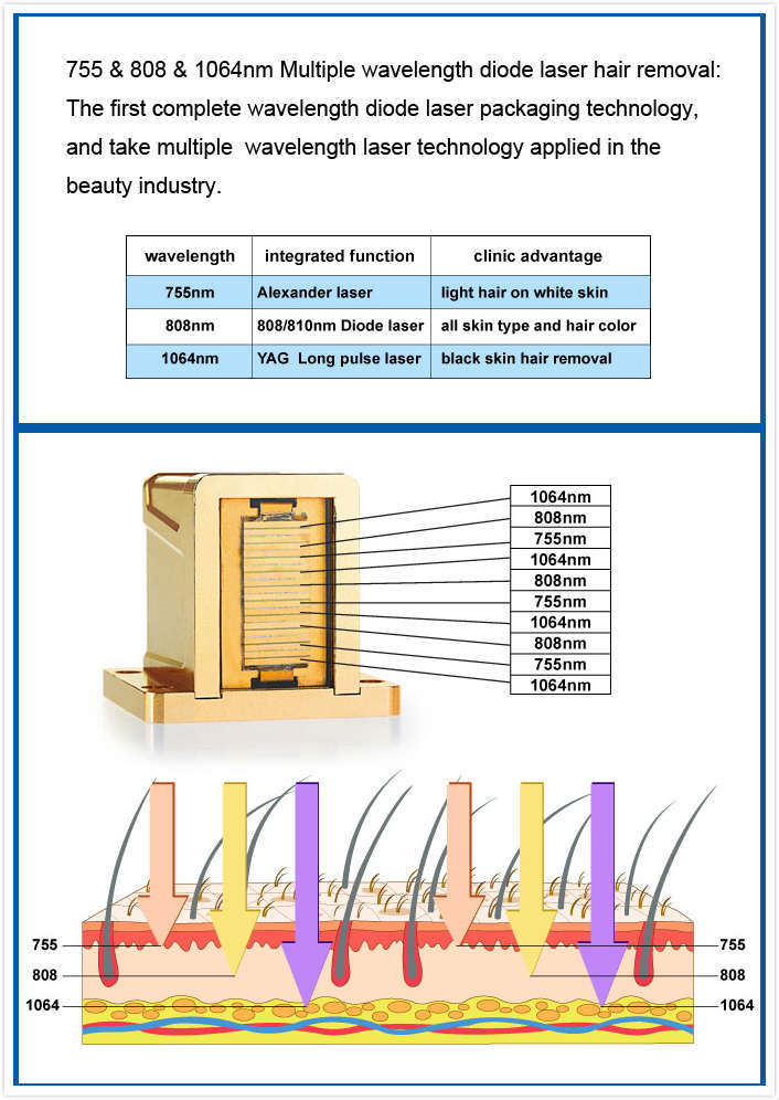 Laser Diode Epilazione Permanente Super Diode Laser Hair Removal