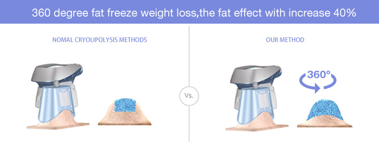 Beauty 360 Fat Freezing Cryolipolysis Cavitation Body Slimming System