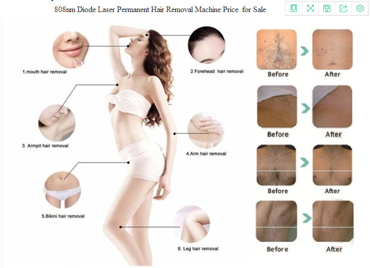 Diode Laser Painless IPL Shr Hair Removal for Salon Instrument