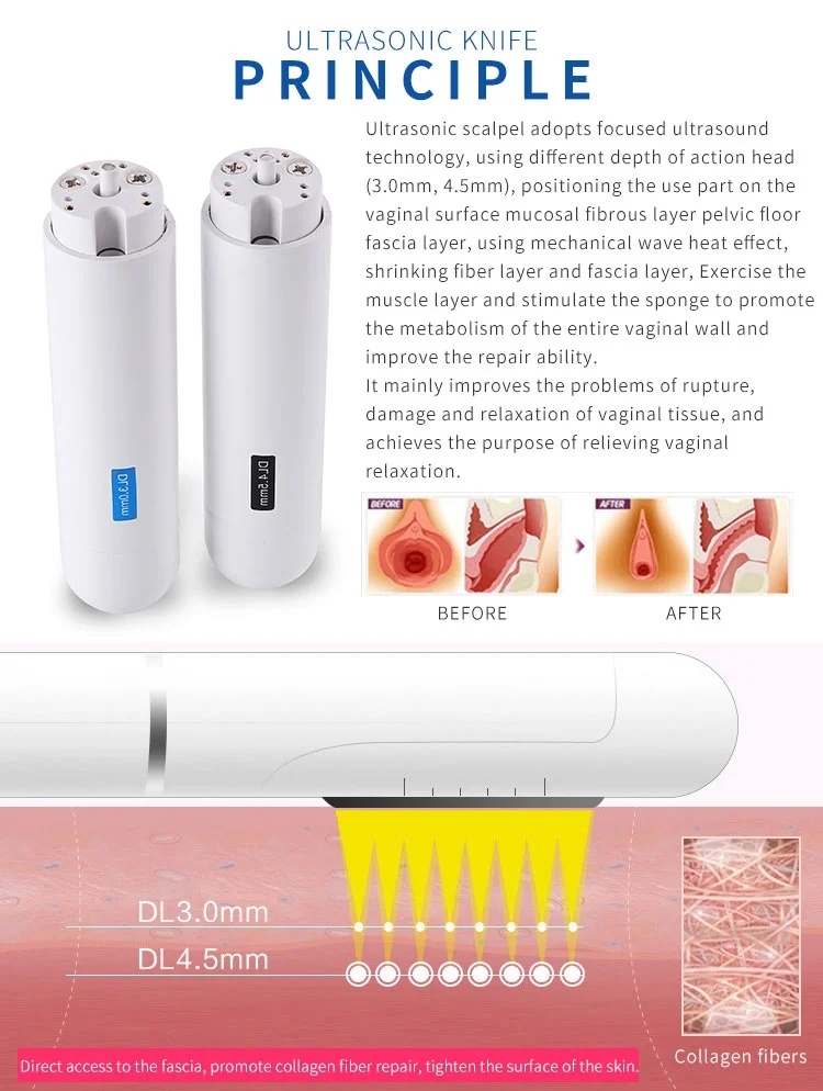 Hifu Vaginal Tightening Machine Portable Vaginal Rejuvenation Beauty Machine