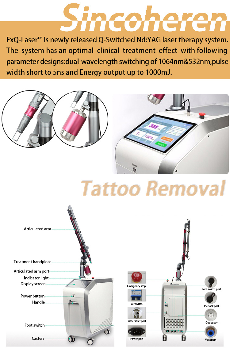 Medical Ce Approved Q Switched ND YAG Laser Tattoo Removal/Tattoo Remover ND YAG Laser
