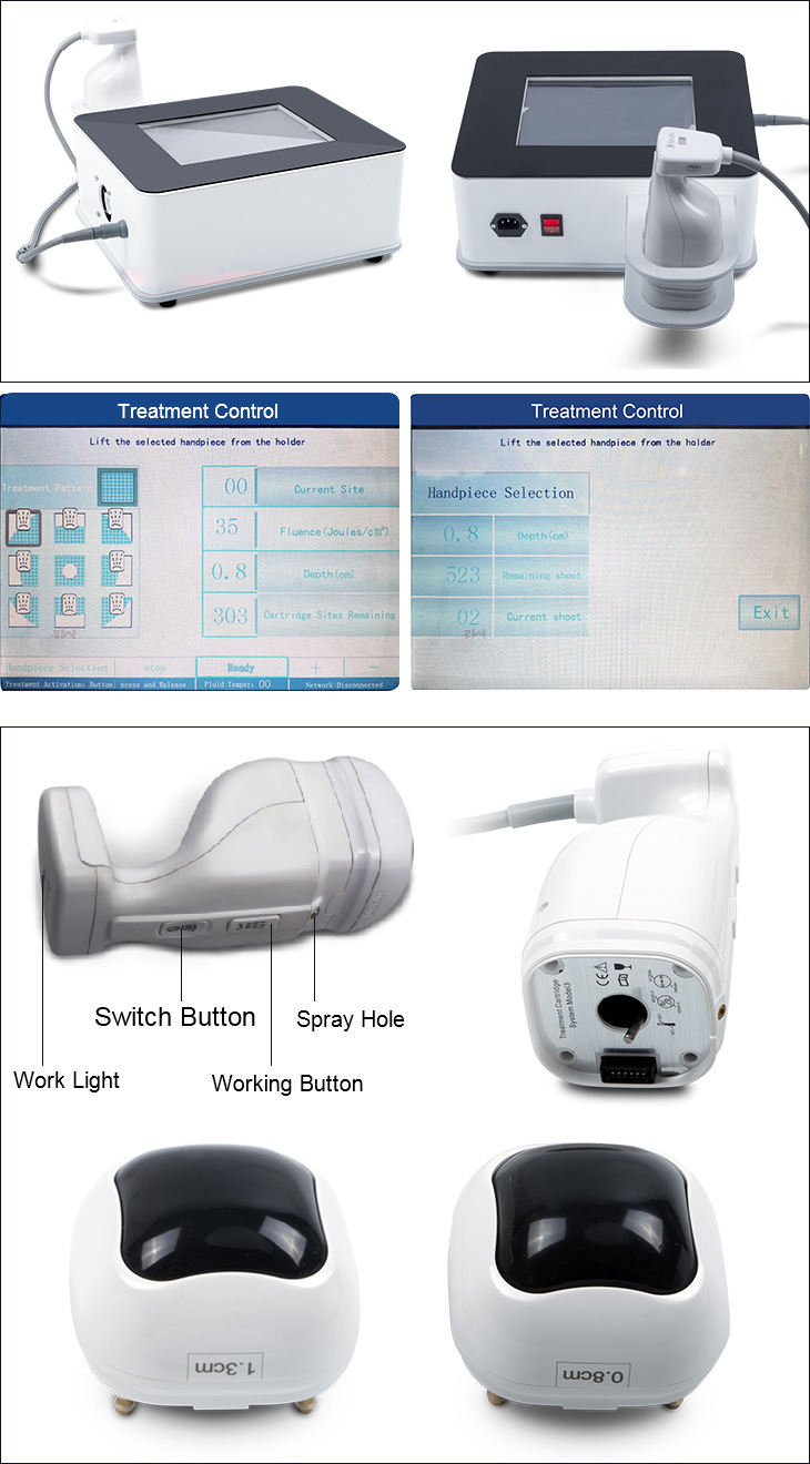 Liposonix Hifu Machine Use at Home Fat Removal Body Slimming Liposonix Machine Beauty Machine