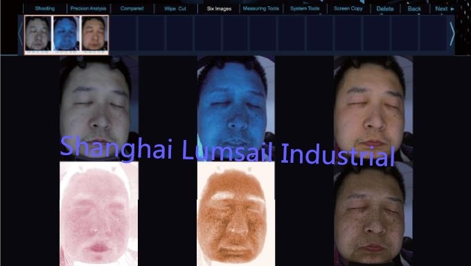 Hot 3D Facial Analysis Best Portable Skin Analyzer Machine