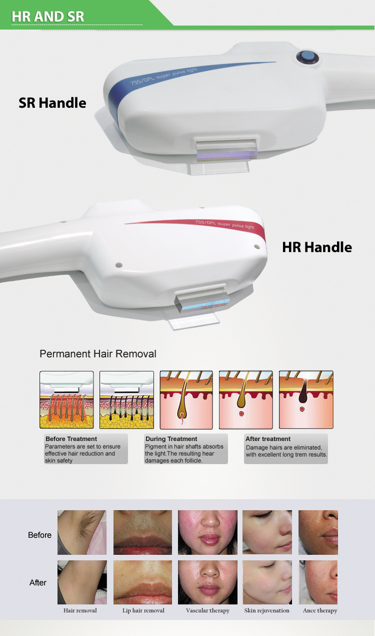 Hot Selling Dpl/Opt/IPL Machine Light Therapy Hair Removal Pigmentation Treatment