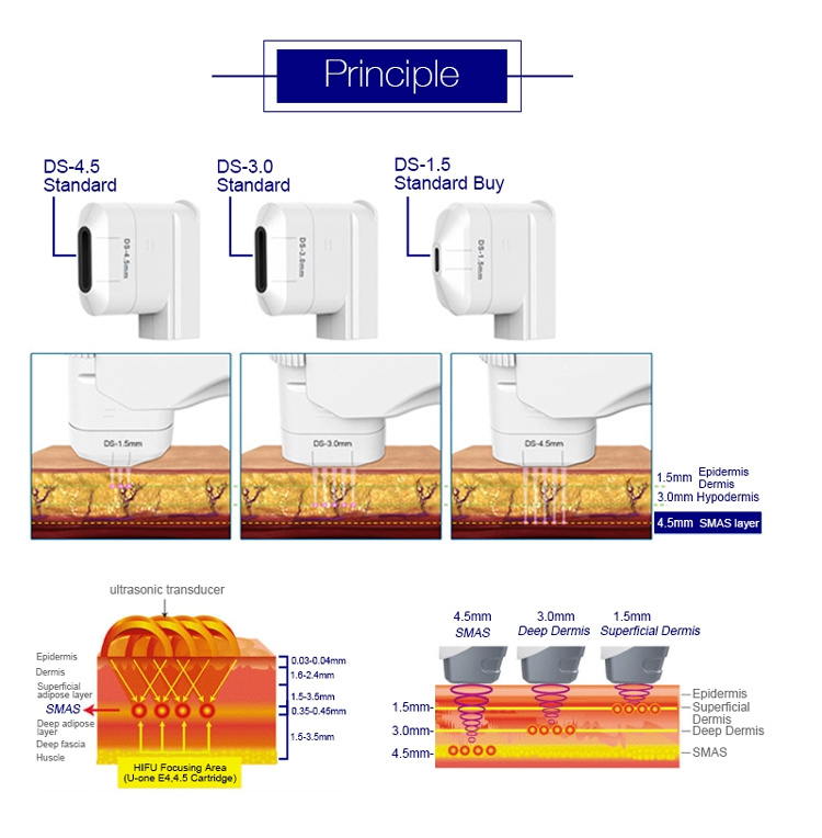 Anti Aging and Eye Hifu Beauty / Hifu Face Lift Machine