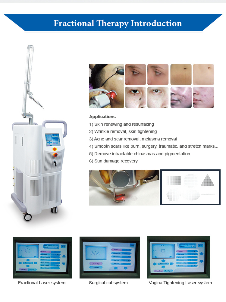 Fractional CO2 Laser Equipment Beauty Equipment/Vaginal Treatment Machine