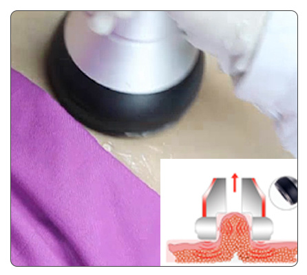 Focused Ultrasound Body Slimming Cavitation RF Machine