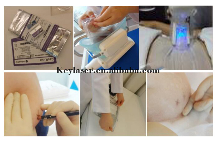 E Cryotherapy Fat Reducation Body Slimming Machine