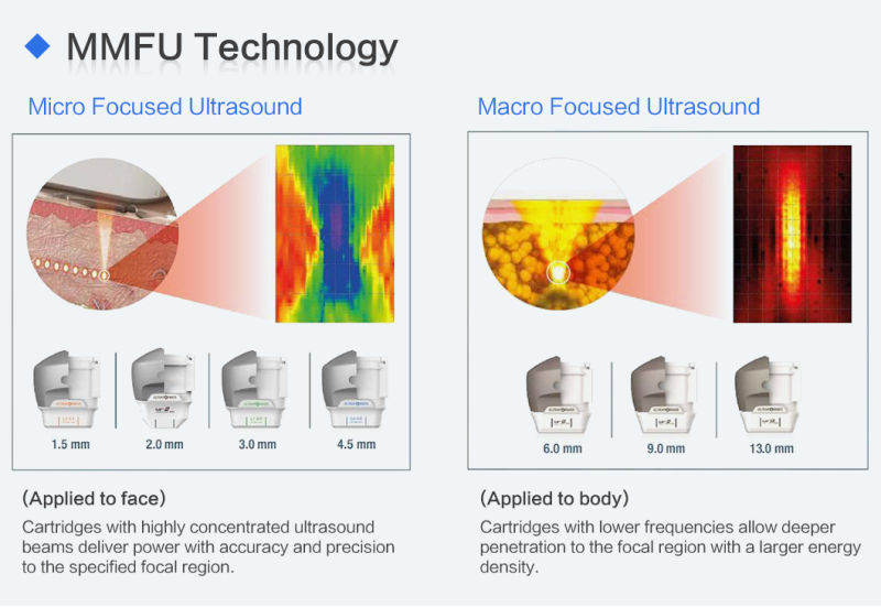 2021 Latest 7D Hifu High-Intense Focused Ultrasound Anti-Aging Beauty Machine