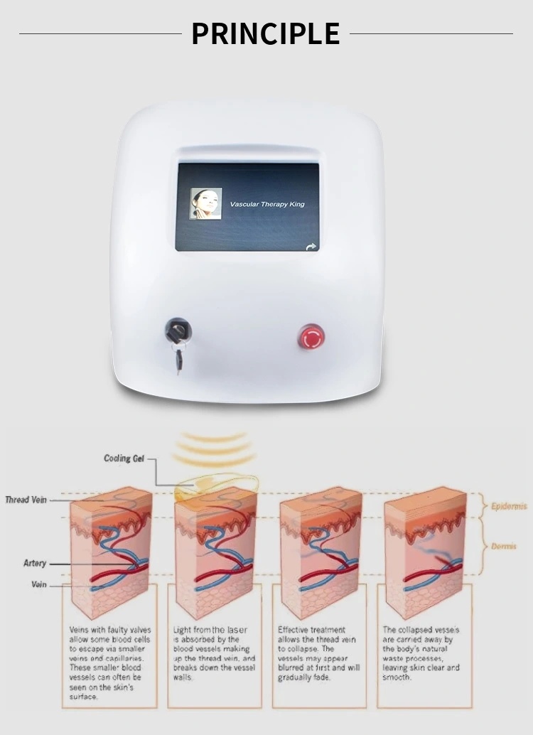 Laser Diode 980nm Beauty Machine for Vascular Removal Treatment Beauty Equipment