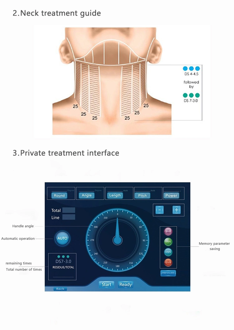 Hifu Portable Beauty Machine for Anti-Aging / Vaginal Tightening