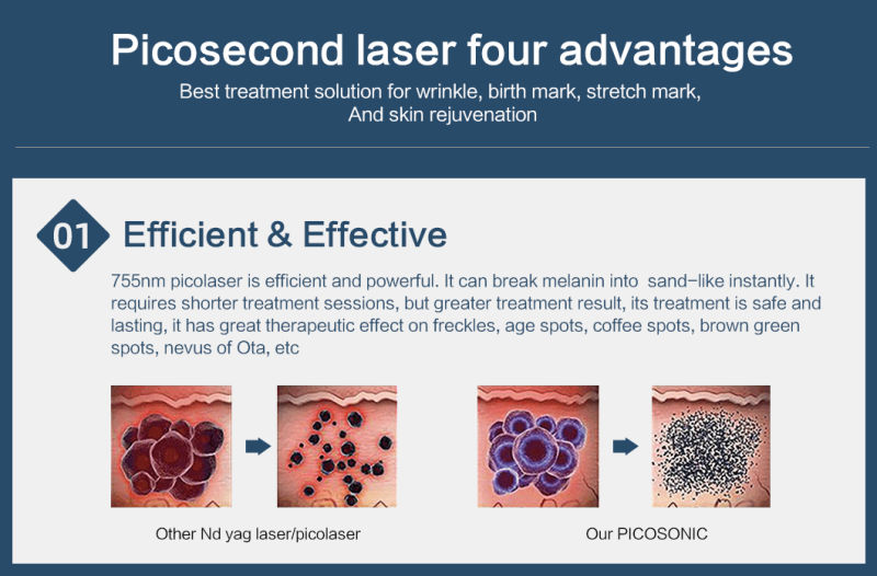 Picosecond Laser Tattoo Removal Pico Laser Spot Removal Pigment Removal Picosecond Laser