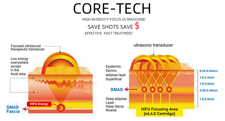 Multifunctional 3 in 1 4D Hifu Machine + Vmax + Hifu Vaginal Beauty Machine