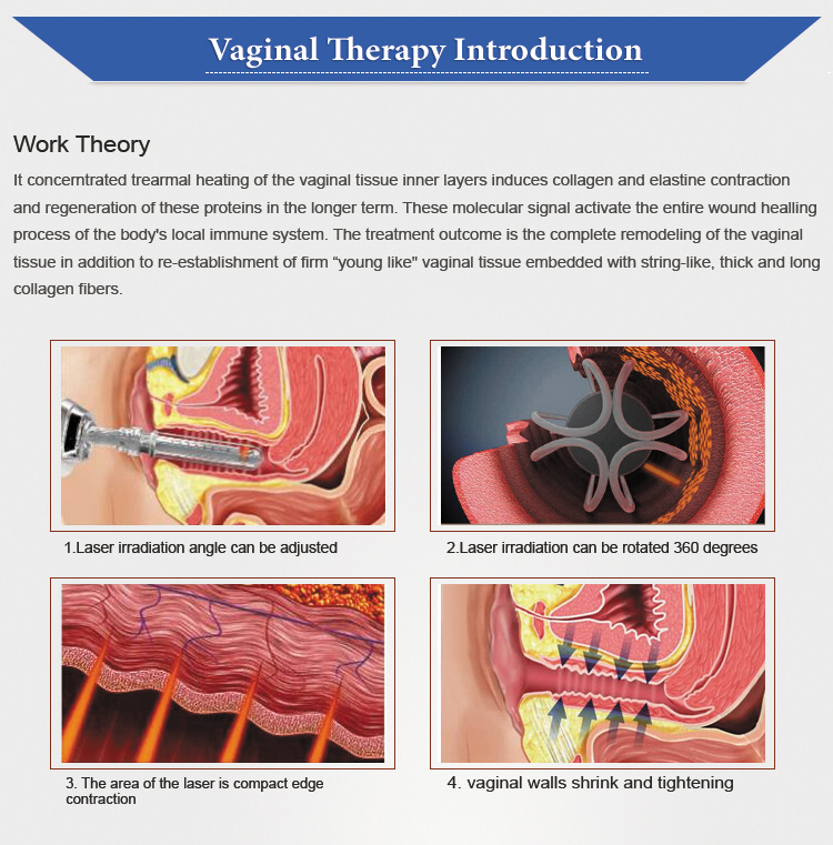 Painless Resurfacing Fractional CO2 Laser Vaginal Rejuvenation CO2 Laser Machine