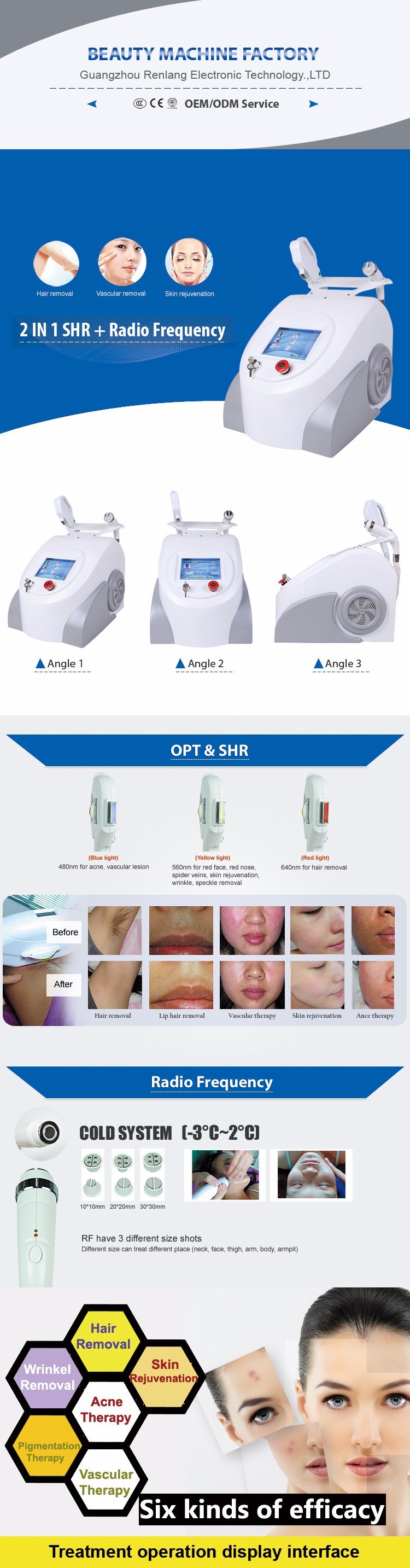 Elight Shr RF Machine for Hair Removal/Wrinkle Removal