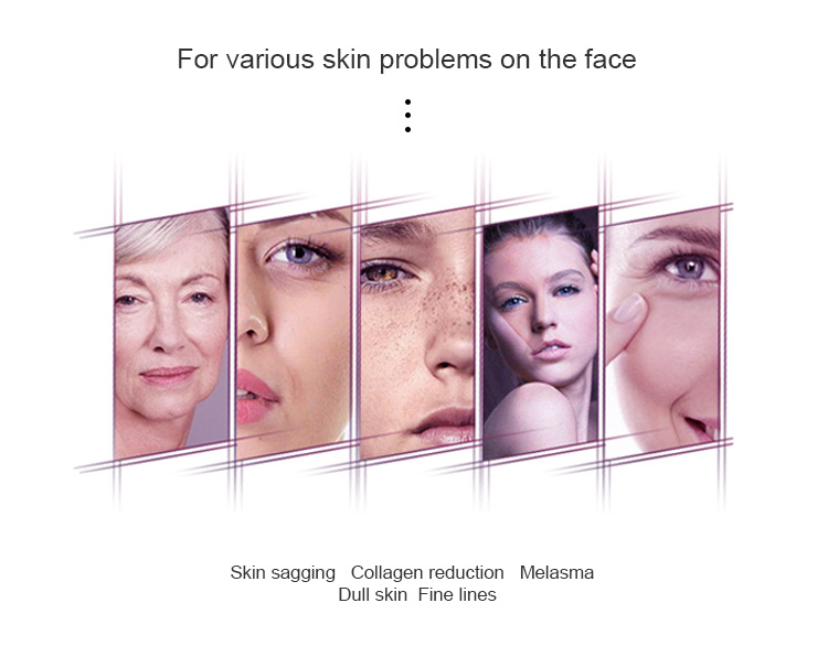 Beauty Device Hand-Held Ultrasonic Facial Massager Skin Tightening Ultrasonic