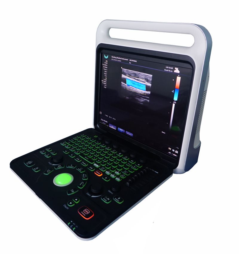 Color Doppler Ultrasound Machine 3D 4D Medical Equipment From China Xf3800
