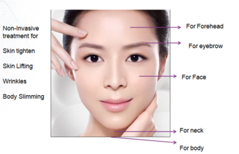 Professional Hifu Ultrasonic Face Lifting Beauty Machine