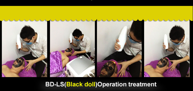 Multifunction IPL Shr Hair Removal Black Doll ND YAG Laser Machine 3 in 1