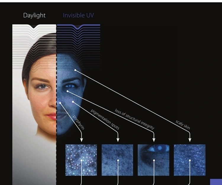 Hifu Machine 3D Digital Observe Facial Skin Analyzer