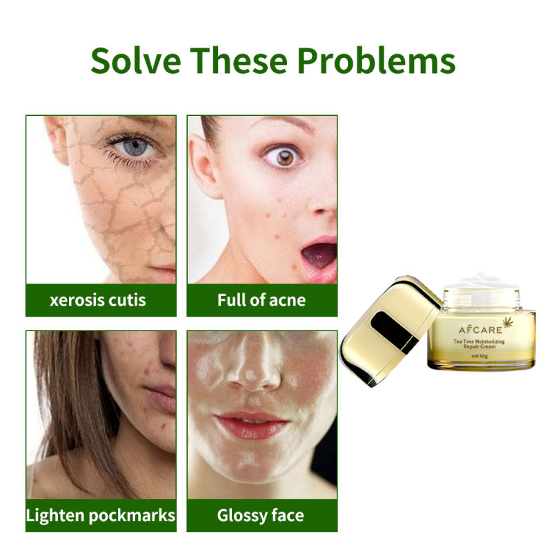 Teatree Cream Sport Acne Treatment Anti Acne Repair Scar Removal Acne Serum Face Serum