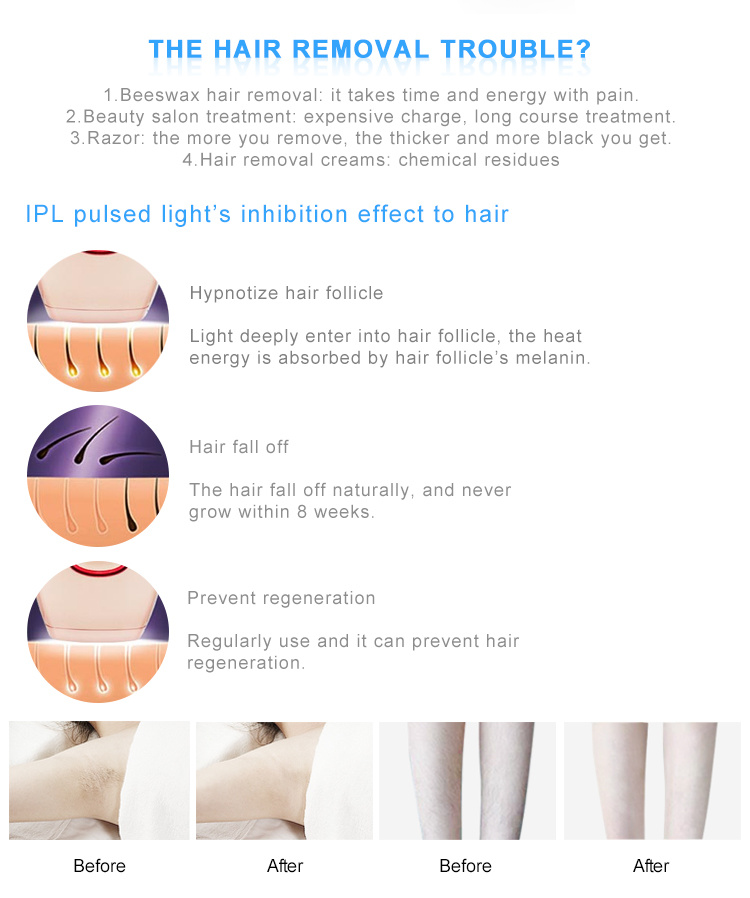 Professional IPL Permanent Hair Removal Machine