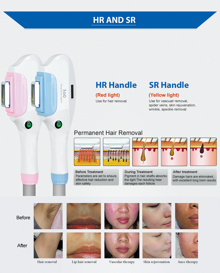High-Grade Depilation Machine Dual IPL Shr Handle Hair Removal Equipment