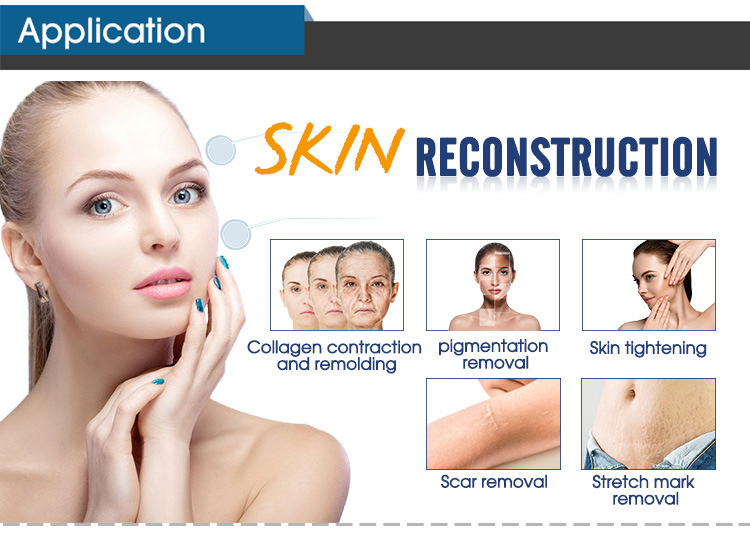 Fractional Co2laser Vaginal Regeneration Beauty Equipment to Remove Scar Wrinkles Skin Regeneration