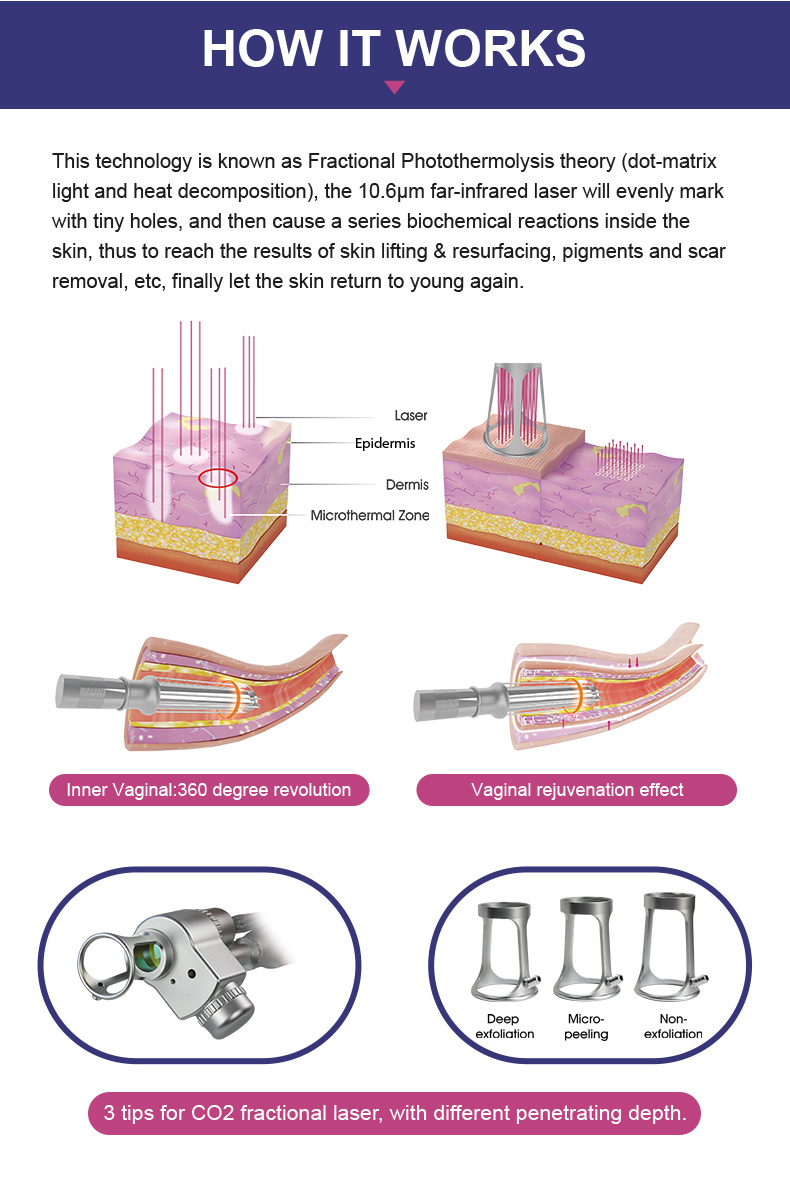 2021 CO2 Fractional Laser with Virginal Treatment Medical Aesthetic Fractional Laser Equipment