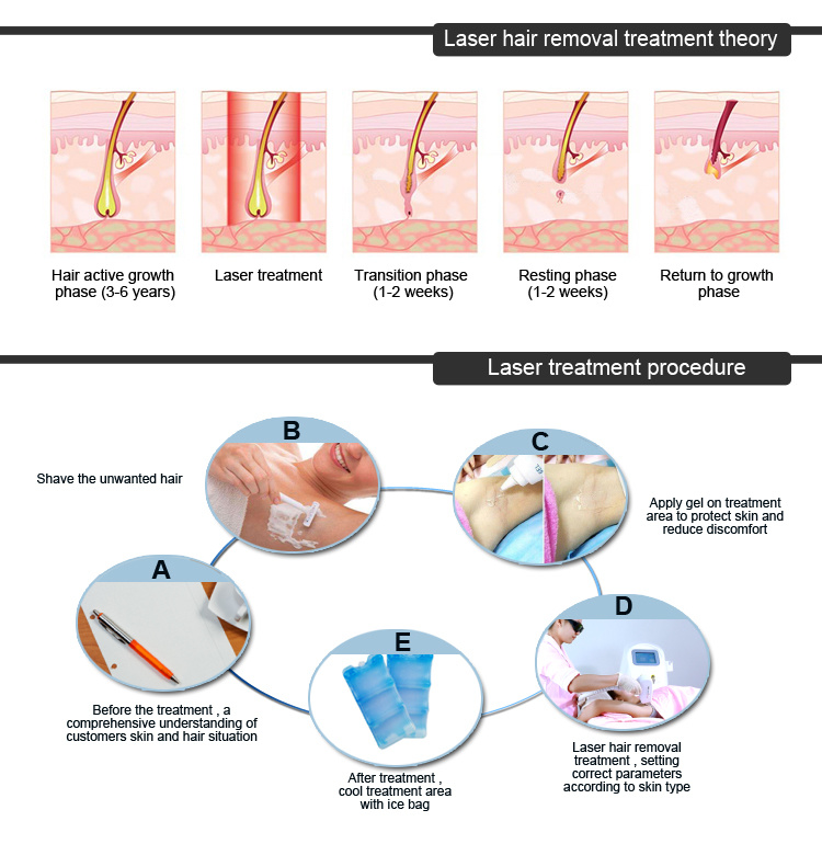 Super Result IPL Machine Hair Removal / Opt Shr Beauty Machine