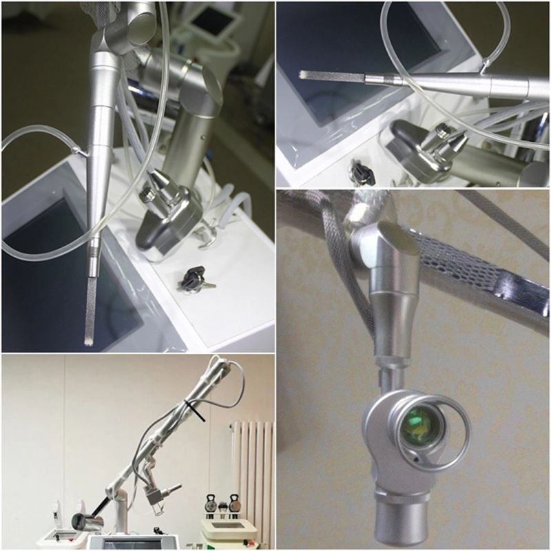Laser Wrinkle Removal Before and After RF Excited CO2 Fractional Laser Skin Tightening Equipment