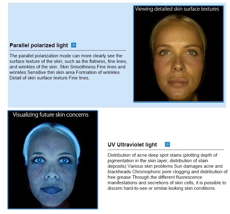 Hifu Machine 3D Digital Observe Facial Skin Analyzer